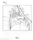 Fig. 09 - Water feature for a spa