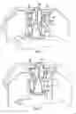 Fig. 05 - Patient bed system