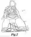 Fig. 03 - Enhanced sole assembly with offset hole