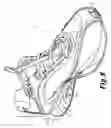Fig. 10 - Enhanced sole assembly with offset hole