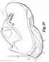 Fig. 17 - Enhanced sole assembly with offset hole