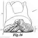 Fig. 18 - Enhanced sole assembly with offset hole