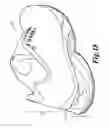 Fig. 17 - Enhanced unitary sole assembly