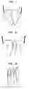 Fig. 04 - Jewelry Device