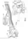 Fig. 05 - Speed and temperature sensing in separate cavities in a single sensing head