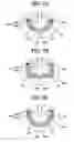 Fig. 08 - Ignition plugs for internal combustion engine