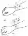 Fig. 07 - Medication holder