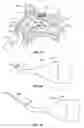 Fig. 07 - Nasal device for delivery to the olfactory region