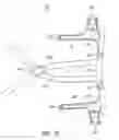 Fig. 03 - Ergonomic and adjustable respiratory mask assembly with headgear assembly