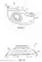Fig. 56 - Ergonomic and adjustable respiratory mask assembly with headgear assembly