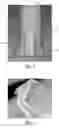 Fig. 02 - Article isolation device and methods