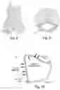 Fig. 06 - Article isolation device and methods