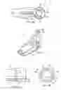 Fig. 05 - System and method for termination of a wire rope