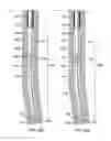 Fig. 30 - Apparatus and methods for drilling a wellbore using casing