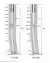 Fig. 31 - Apparatus and methods for drilling a wellbore using casing