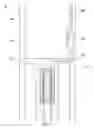 Fig. 04 - Jack element adapted to rotate independent of a drill bit