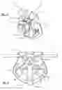 Fig. 03 - Fall arrest device and system incorporating the same