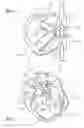 Fig. 04 - Fall arrest device and system incorporating the same