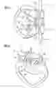 Fig. 05 - Fall arrest device and system incorporating the same