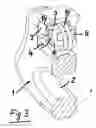 Fig. 04 - Swinging handle for a kitchen vessel