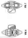Fig. 05 - Surgical fastener applying apparatus
