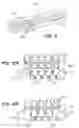 Fig. 04 - Anastomosis Stapler