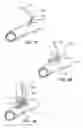 Fig. 07 - Anastomosis Stapler