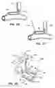 Fig. 09 - Anastomosis Stapler