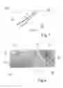 Fig. 04 - Method of processing seals like leaf seals