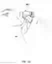 Fig. 22 - Ophthalmic fluid delivery device and method of operation