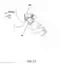 Fig. 23 - Ophthalmic fluid delivery device and method of operation