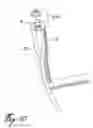 Fig. 07 - Device for spraying a fluid and a brush cutter provided with said device