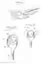 Fig. 02 - Tool for picking up a golf ball