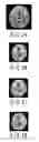 Fig. 16 - Data processing system, data processing method, diagnostic imaging apparatus, and magnetic resonance imaging apparatus