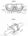 Fig. 05 - Noise filter