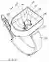 Fig. 10 - Transmitter to bottle attachment means