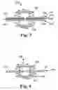 Fig. 08 - Neutralizing electromagnetic noise for a capacitive input device
