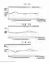 Fig. 05 - Image formation device and method for correcting periodic variations