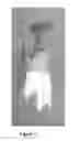Fig. 07 - LAMP SHADE SYSTEM