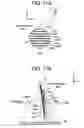 Fig. 10 - Image reconstructing method and X-ray CT apparatus