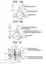 Fig. 12 - Image reconstructing method and X-ray CT apparatus