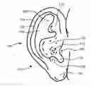 Fig. 01 - Earset assembly