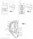 Fig. 02 - Earset assembly