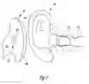 Fig. 02 - SWITCHING STRUCTURES FOR HEARING ASSISTANCE DEVICE