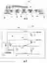 Fig. 03 - Hearing aid having improved RF immunity to RF electromagnetic interference produced from a wireless communications device