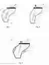 Fig. 02 - Hearing device to be at least partially inserted into an ear canal