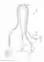 Fig. 01 - Lanyard assembly for audio device