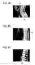 Fig. 04 - Magnetic resonance imaging apparatus, method of making an imaging-plan, and method of imaging