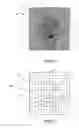 Fig. 02 - Face detection in digital images
