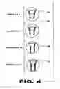 Fig. 05 - Preset depth adapter and finger guard for screws and nails when installing sheetrock